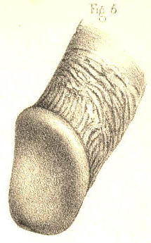 Illustration: