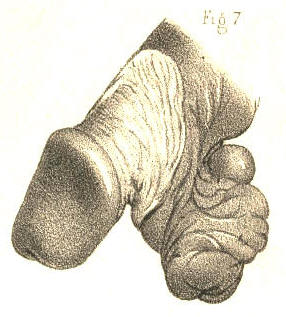 Illustration: