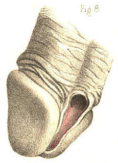Illustration:
