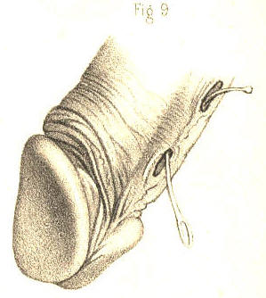 Illustration: