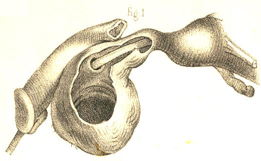 Illustration: