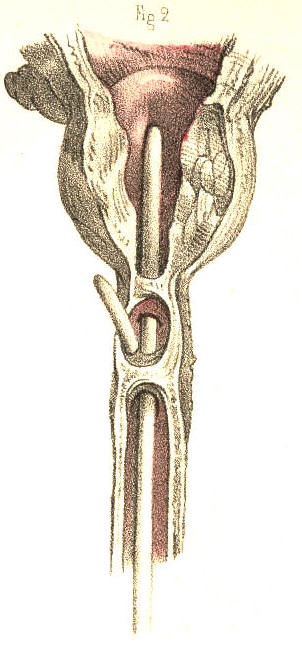 Illustration: