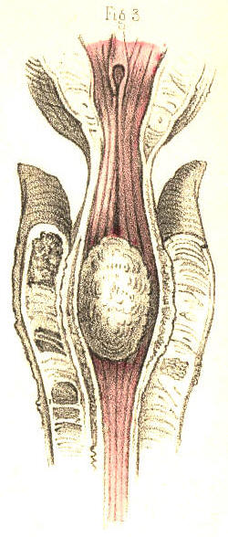 Illustration: