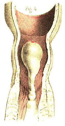 Illustration: