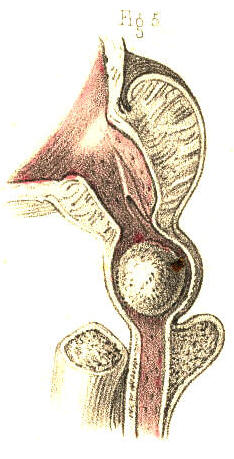 Illustration: