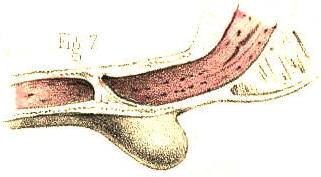 Illustration: