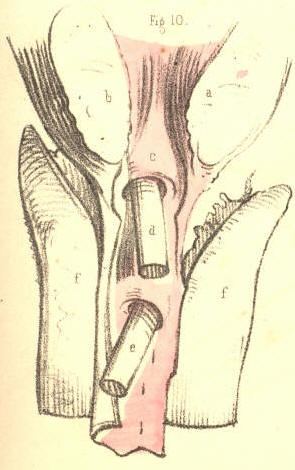 Illustration: