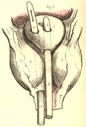 Illustration: