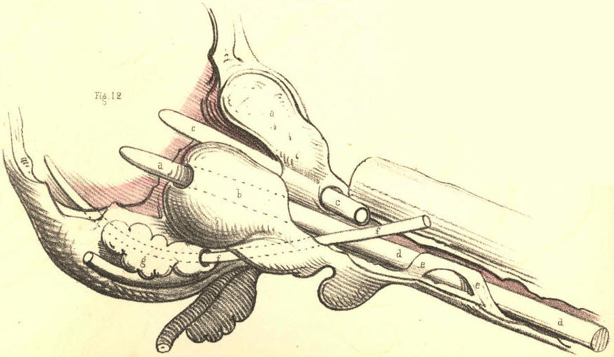 Illustration: