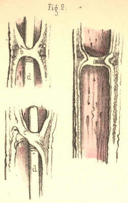 Illustration: