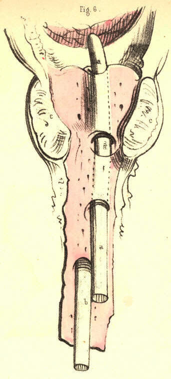Illustration: