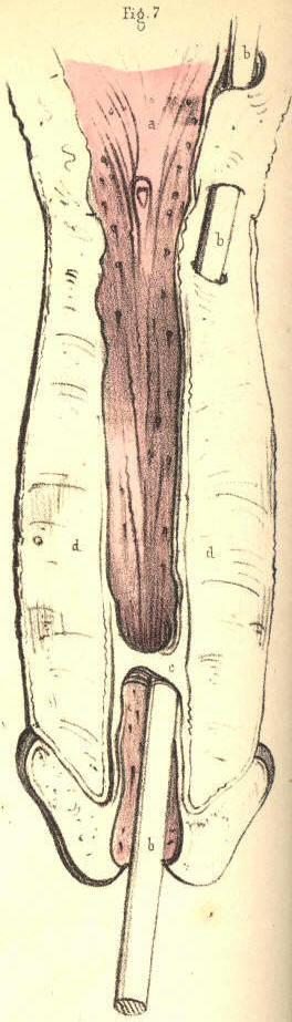 Illustration: