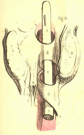 Illustration: