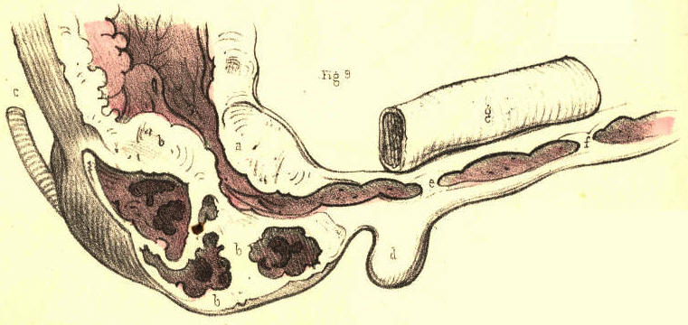Illustration: