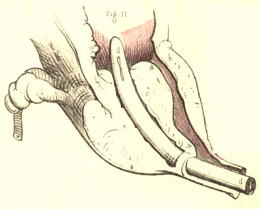 Illustration: