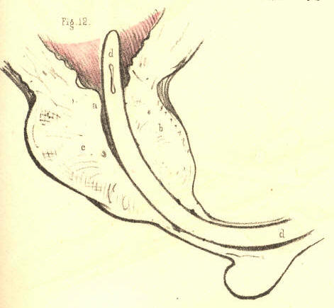 Illustration:
