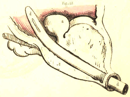 Illustration: