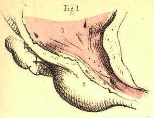 Illustration: