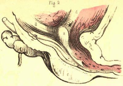 Illustration: