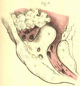 Illustration: