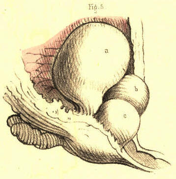 Illustration:
