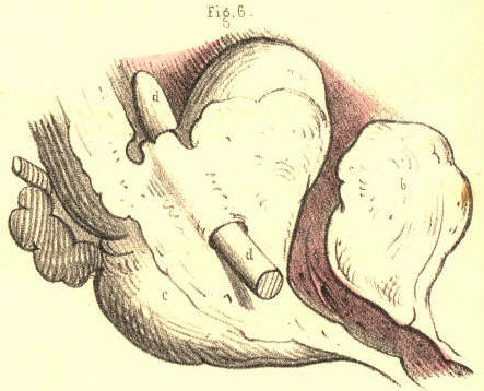 Illustration: