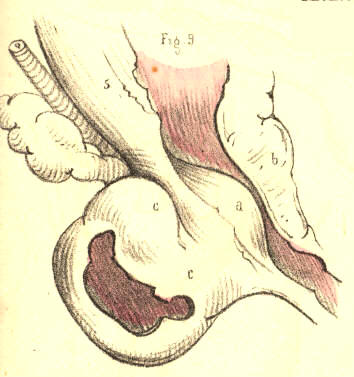 Illustration: