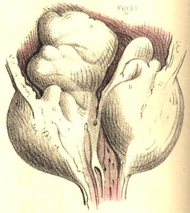 Illustration: