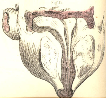 Illustration: