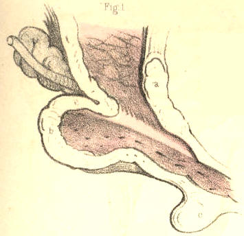 Illustration: