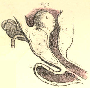 Illustration: