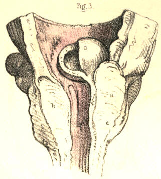 Illustration: