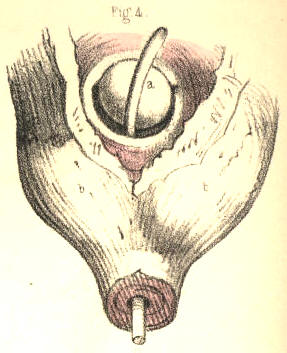 Illustration: