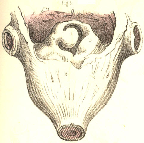 Illustration: