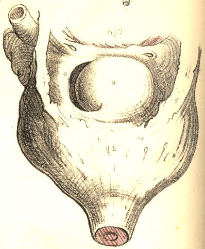 Illustration: