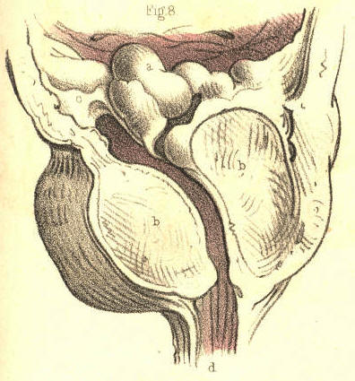 Illustration: