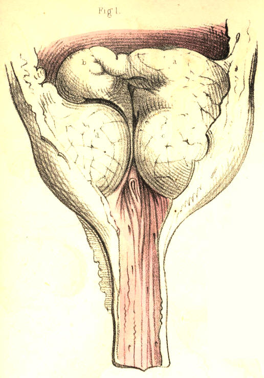 Illustration: