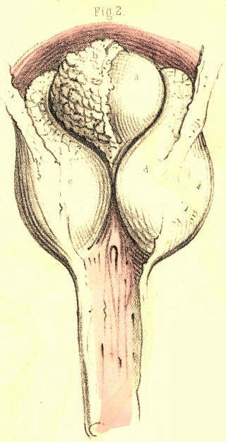 Illustration: