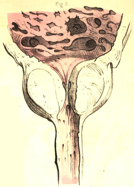 Illustration: