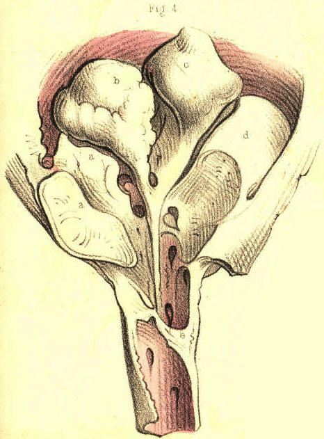 Illustration: