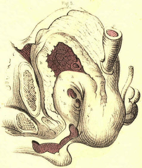 Illustration:
