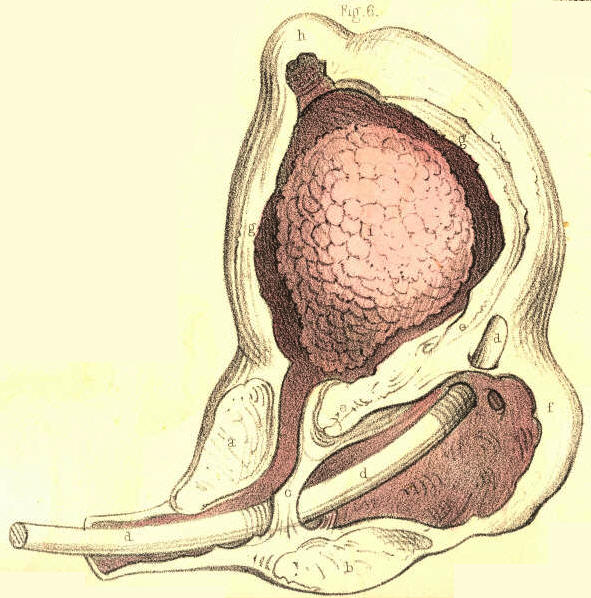 Illustration: