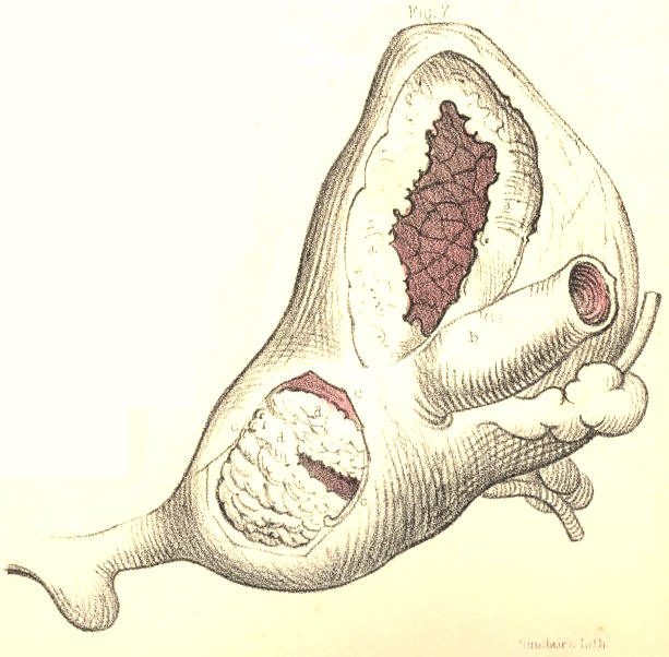 Illustration:
