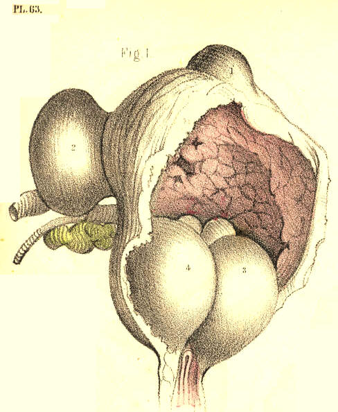 Illustration: