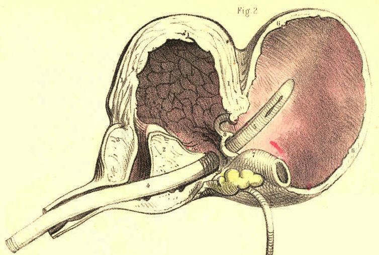 Illustration: