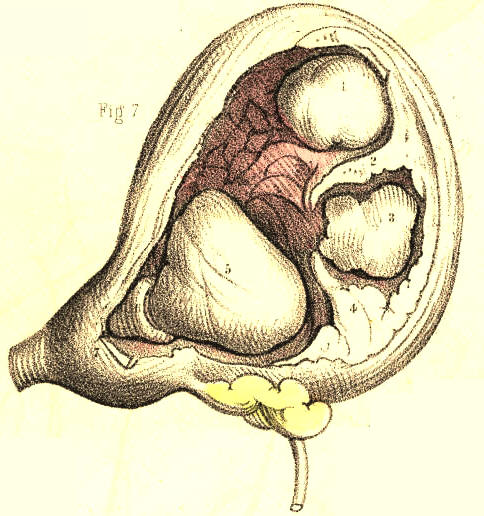 Illustration: