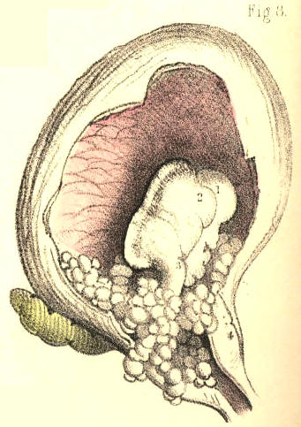 Illustration: