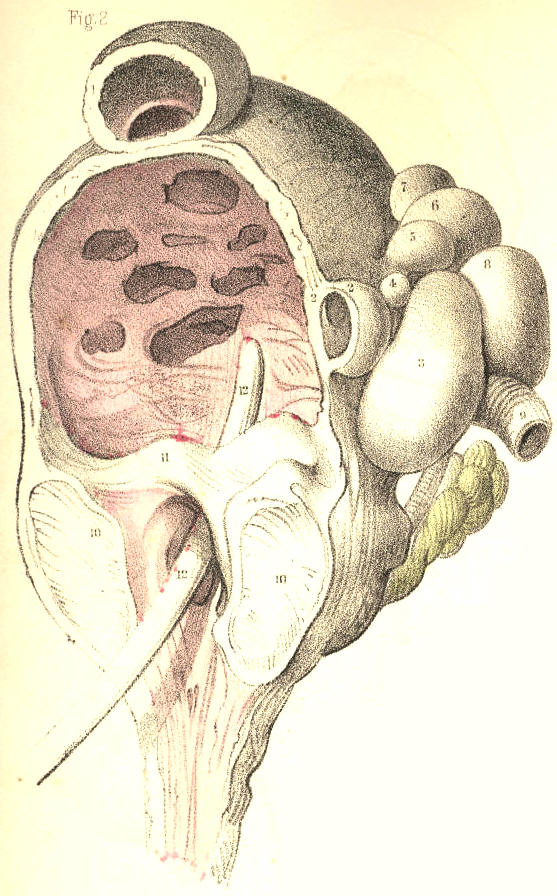 Illustration: