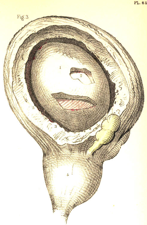 Illustration: