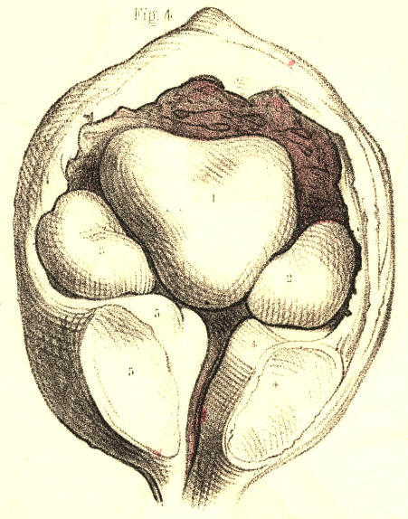 Illustration: